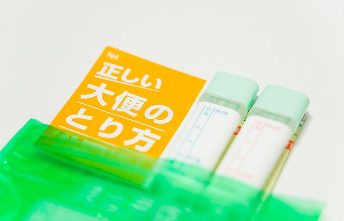 大腸カメラ（下部消化管内視鏡）検査について