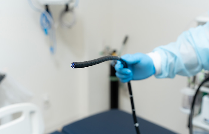 世界消化器内視鏡学会(WEO)優良施設での経験