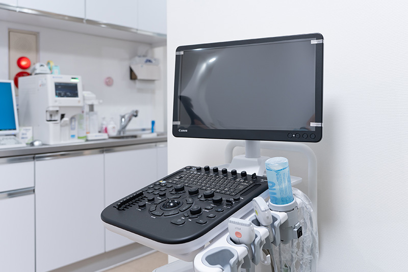 超音波検査装置